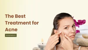 The Best Treatment for Skin Acne